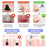 Facial Vacuum Suction Tool for Deep Cleansing with 4 Nozzles
