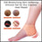 Heel repair silicone gel for dry skin.